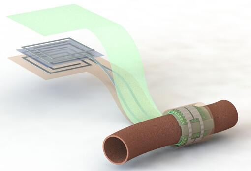 上圖描繪了這款可生物降解的壓力傳感器，它圍繞著一根血管，天線在左側(分離的層狀結構，展示了天線結構的細節)